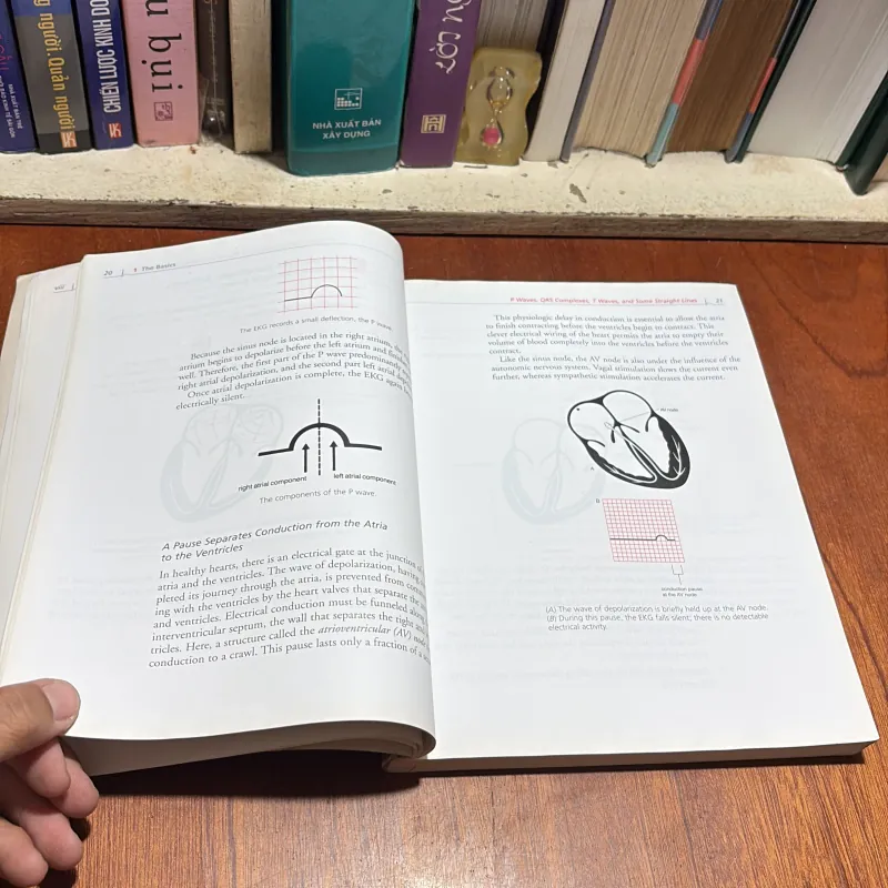 II Sách Y Học (Tiếng Anh): The Only EKG Book _ You’ll Ever Need - Malcolm S. Thaler 934720