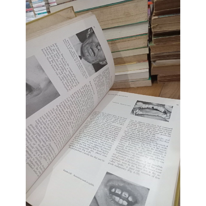 Major's PHYSICAL DIAGNOSIS - Mahlon H. Delp, M.D., Robert T. Manning, M.D. 791689