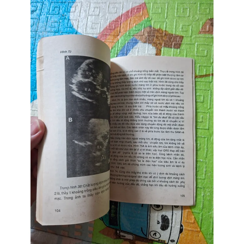 Chẩn đoán siêu âm các bệnh tim mạch 971636