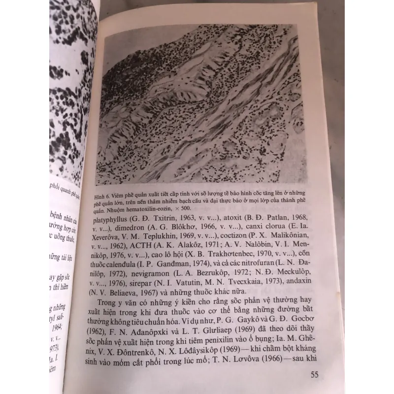 Bệnh do thuốc trong lâm sàng bệnh truyền nhiễm 800139