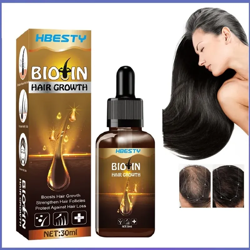 Chai xịt dưỡng kích mọc tóc, giúp tóc mọc dài nhiều và dày, mọc tóc nhanh, bóng, mượt 800849