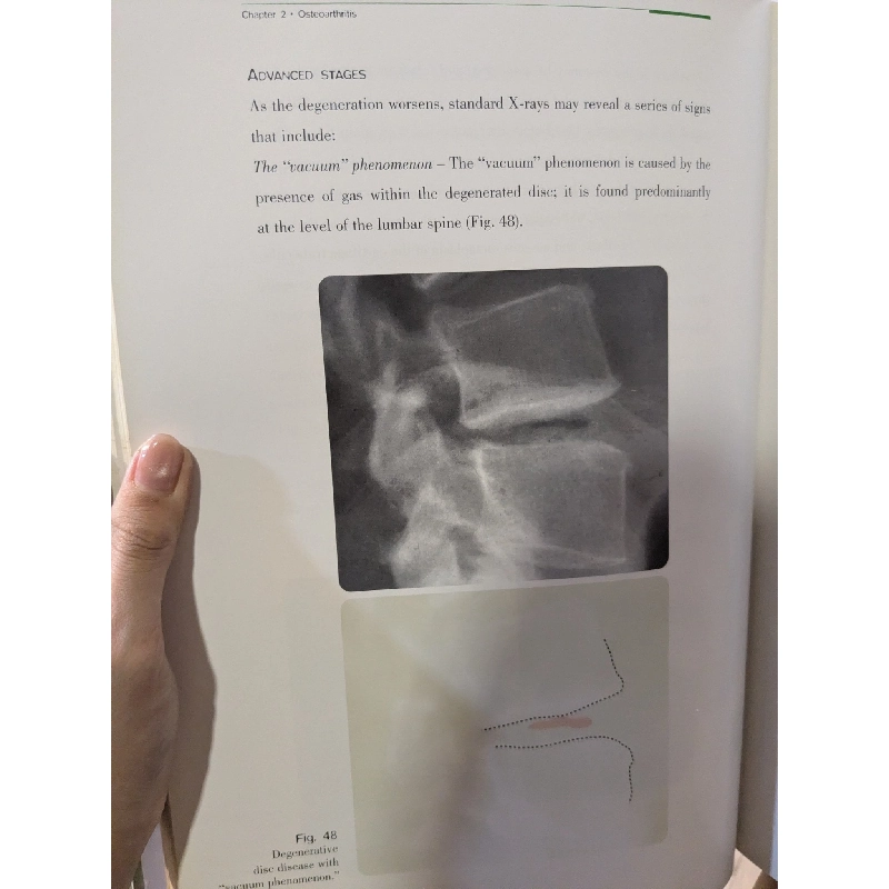 Bone and joint imaging - Francesco Priolo 974444