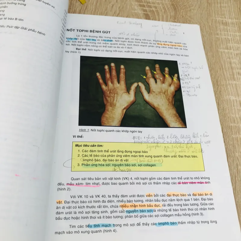 BÀI GIẢNG - ATLAS THỰC TẬP GIẢI PHẪU BỆNH  1004274