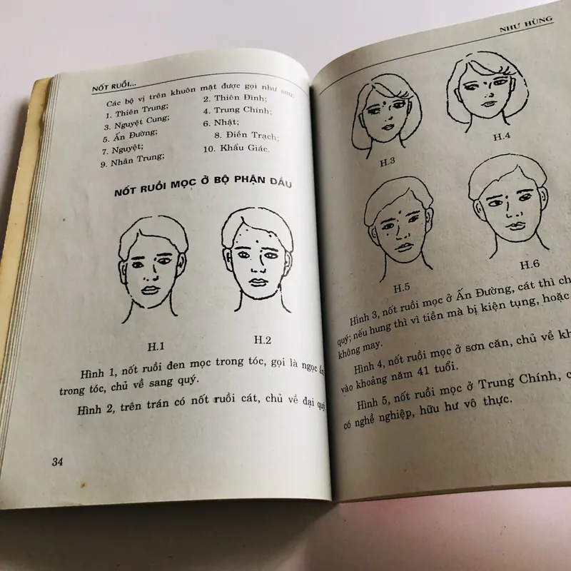 NỐT RUỒI DƯỚI CÁI NHÌN CỦA Y HỌC & TƯỚNG HỌC  735157