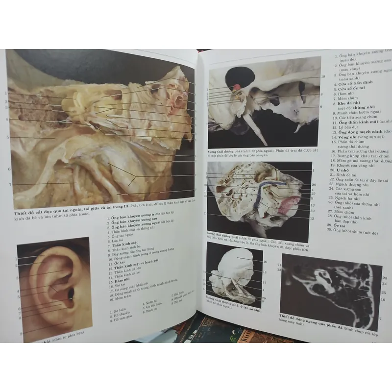 ATLAS GIẢI PHẪU NGƯỜI 592306