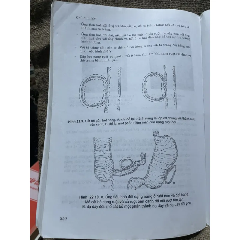 Cấp cứu ngoại khoa - nhi khoa - sách khổ lớn  1000485