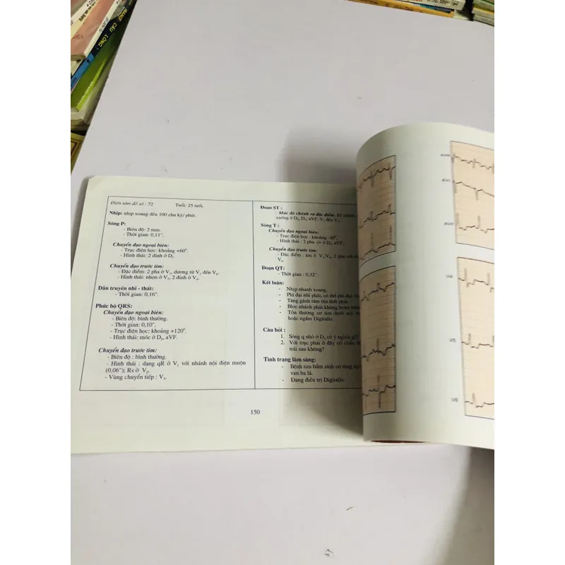 BÀI TẬP ĐIỆN TÂM ĐỒ (M. Englert – R. Bernard) 598068