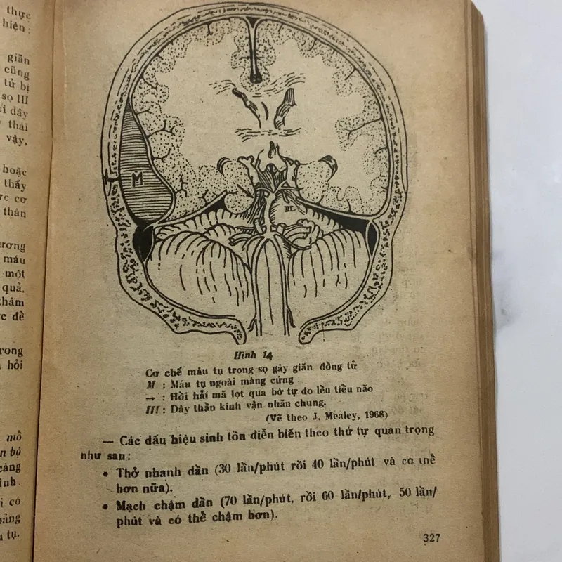 Bệnh lý ngoại khoa thần kinh, Lê Xuân Trung, lưu hành nội bộ 709163