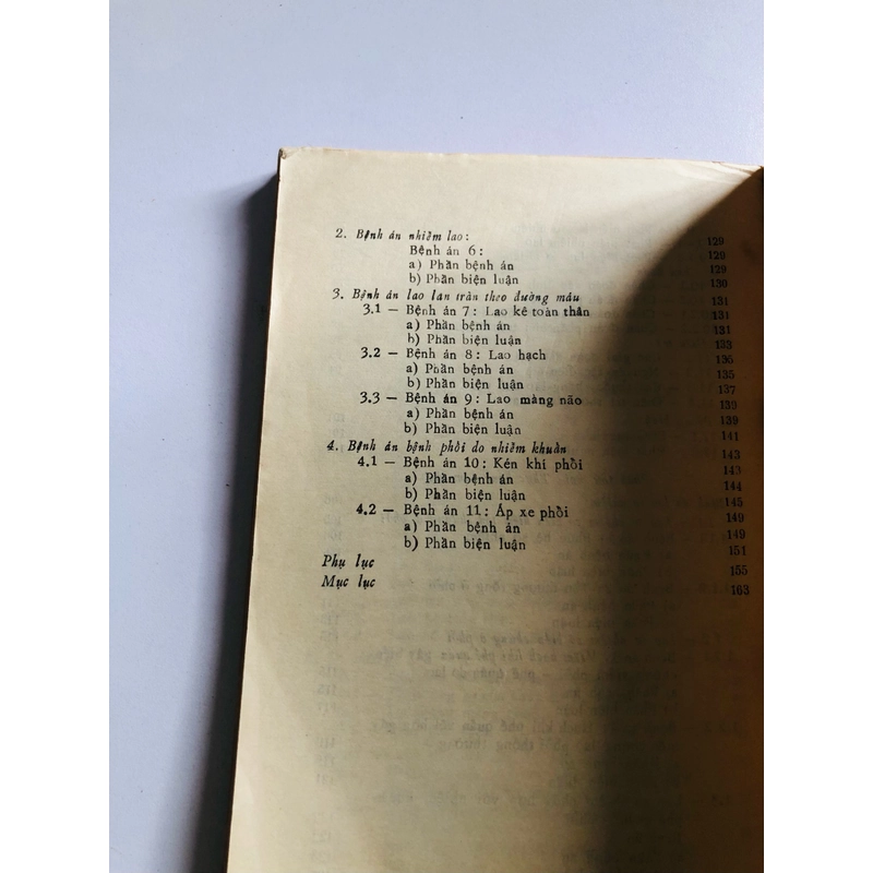 LAO SƠ NHIỄM Ở TRẺ EM 529550