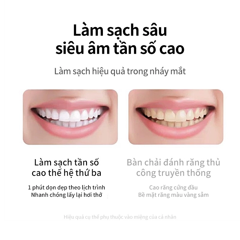 Bàn chải điện thông minh 308876