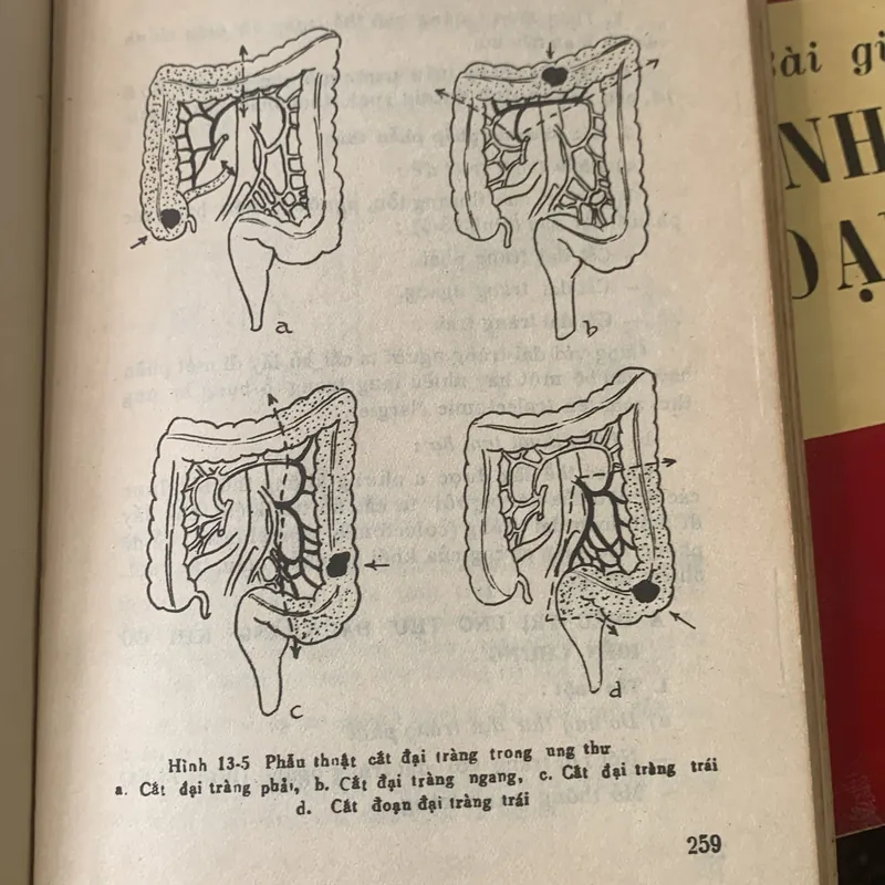 Bài giảng bệnh học ngoại khóa tập 1 - 2, lưu hành nội bộ 709608