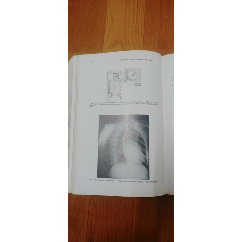 X QUANG GIẢI PHẪU, BẢN TIẾNG ANH  506253