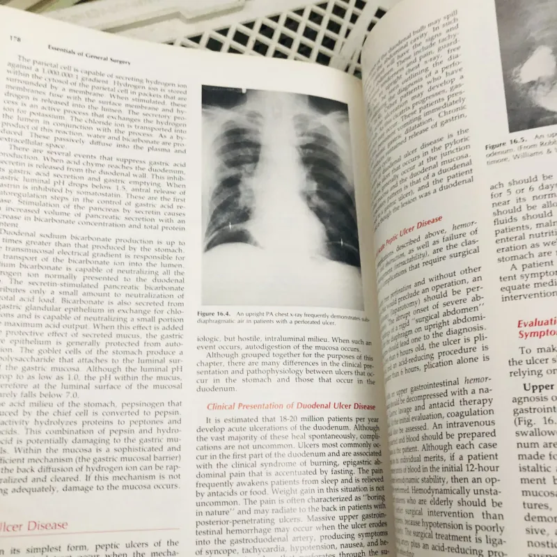 ESSENTIALS OF GENERAL SURGERY – Peter F. Lawrence Sách y học kinh điển về ngoại tổng quát 799196