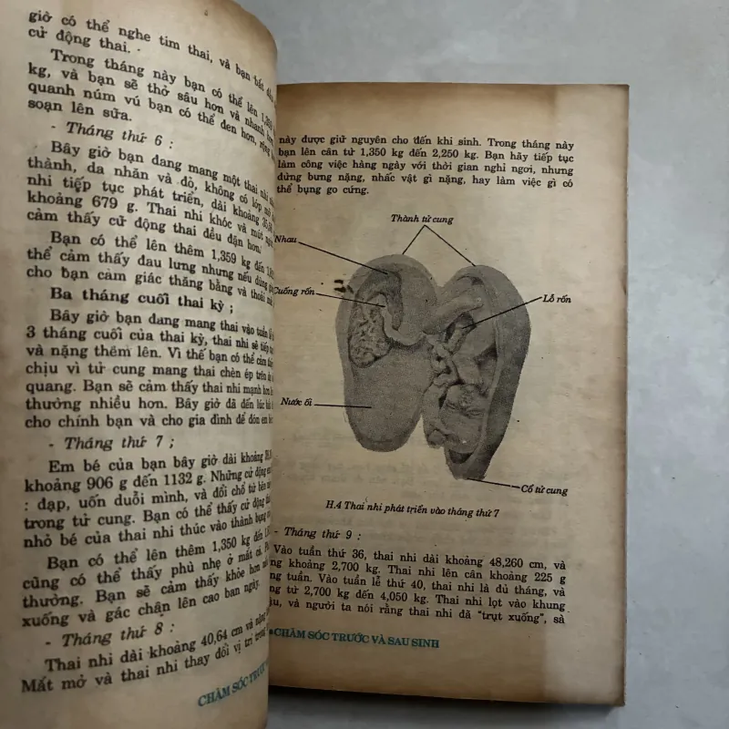 Chăm sóc trước và sau sinh - 1992s 1009080
