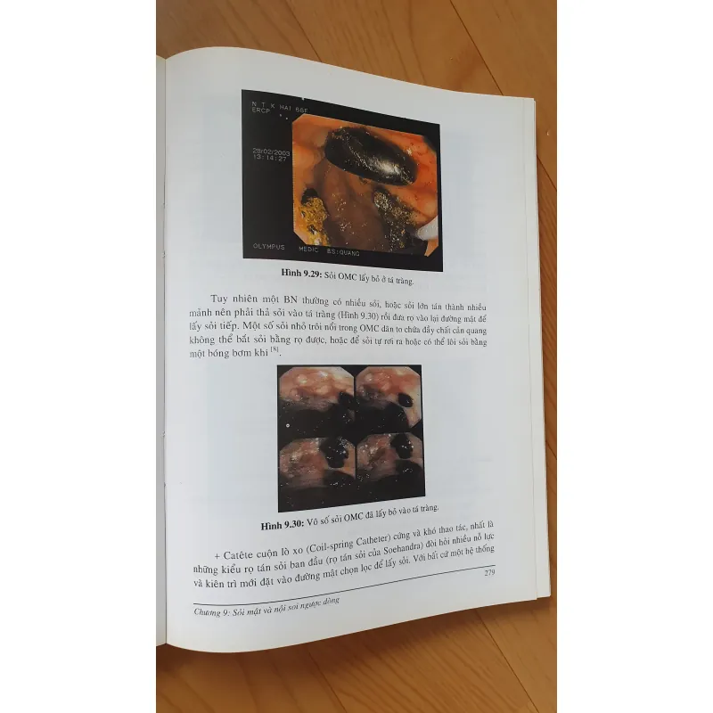 NỘI SOI MẶT TUY  754032