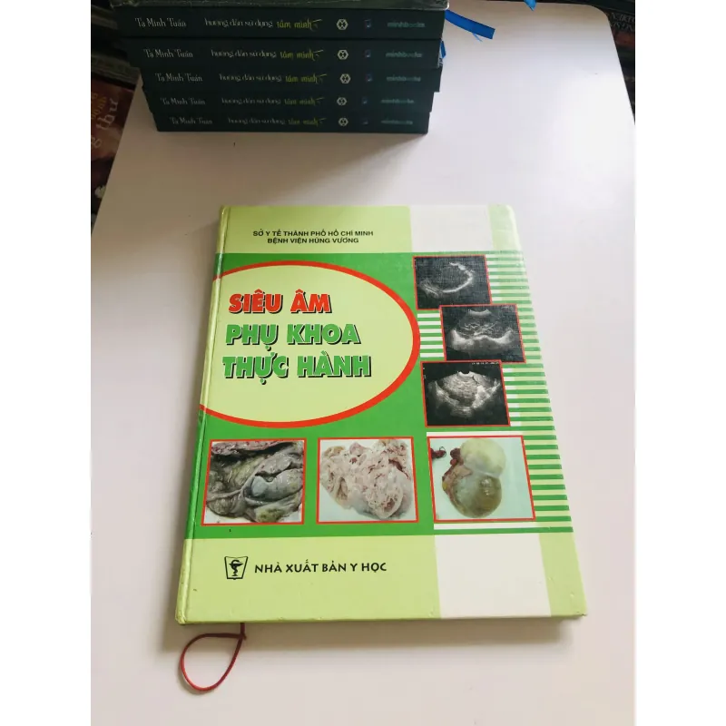 SIÊU ÂM PHỤ KHOA THỰC HÀNH  756269