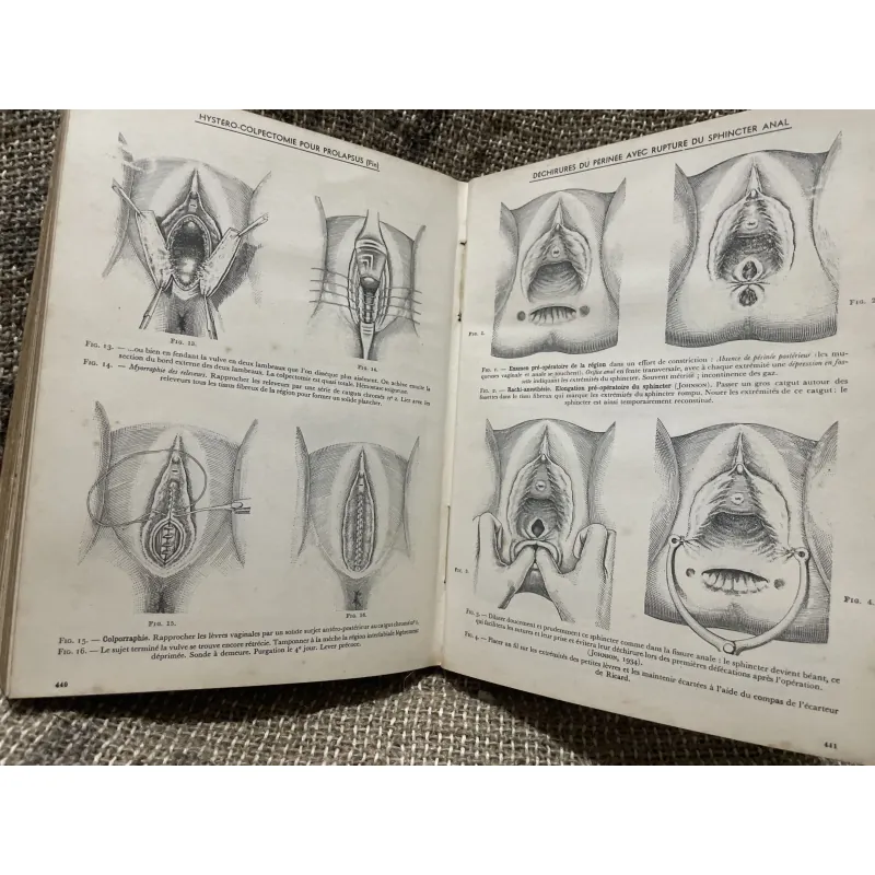 Kthuật phẫu thuật bằng hình ảnh -TECHNIQUE CHIRURGIEALE EN FIGURES G.JEANNENEY& J.MAGENDIE 1006345