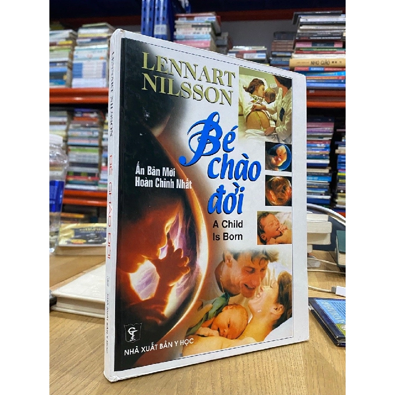 Bé chào đời - Lennart Nilsson 537038