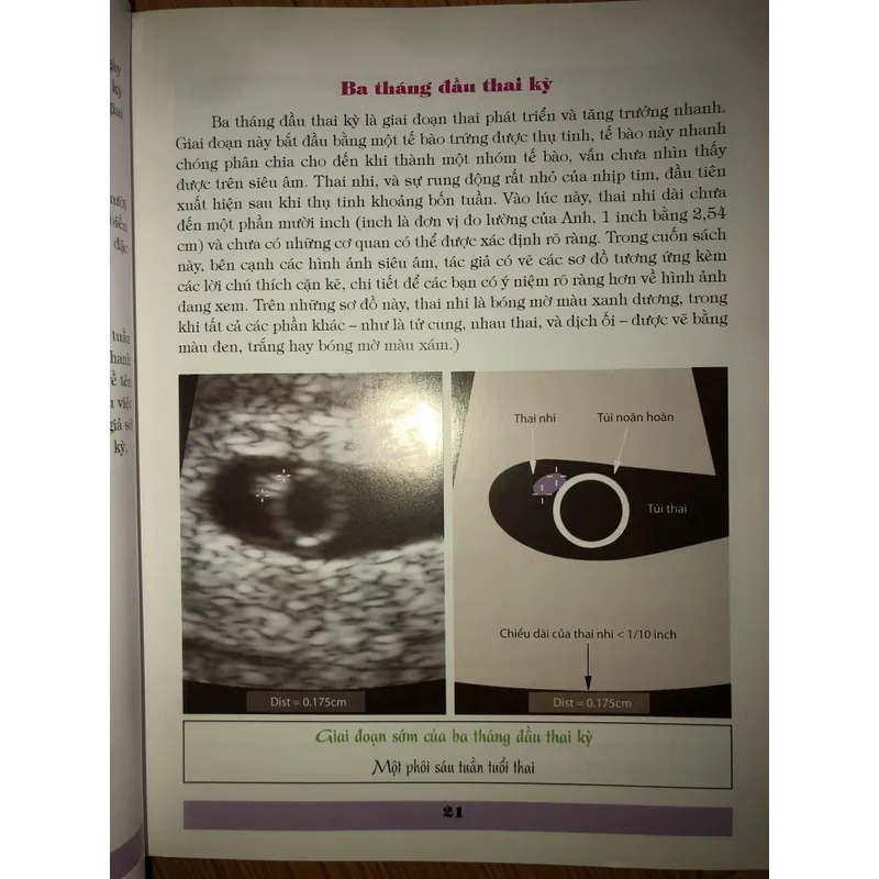 Cuộc hành trình 9 tháng kỳ diệu trong bụng mẹ  674618