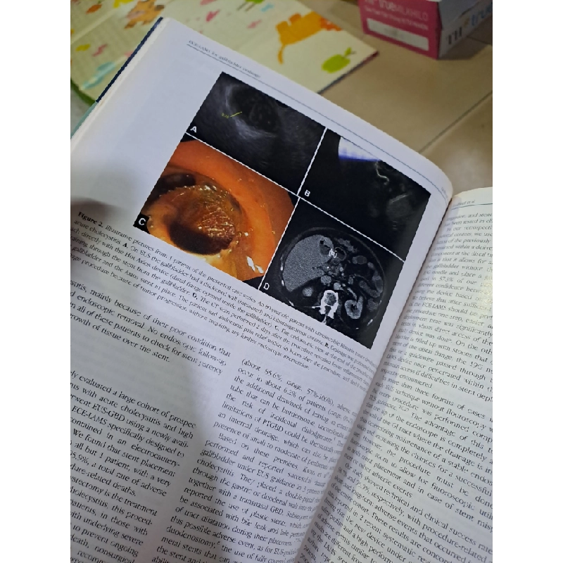 GIE Gastrointestinal Endoscopy volume 86 no 4 10/2017 HCM0808 TẠP CHÍ, THIẾT KẾ, THỜI TRANG 527157