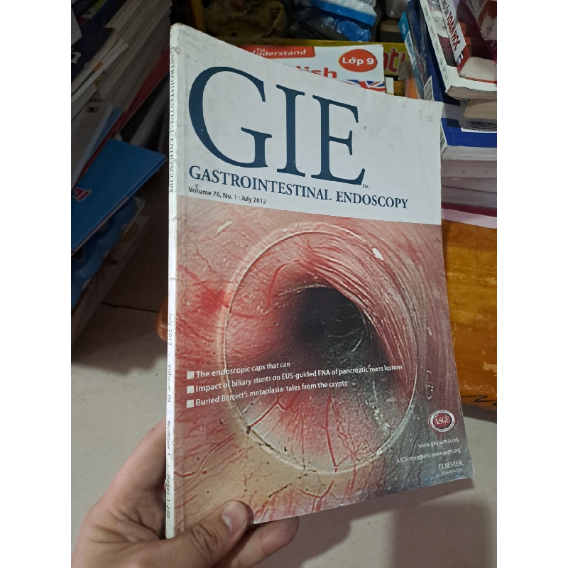 GIE Gastrointestinal Endoscopy volume 76 no 1 7/2012 HCM0808 TẠP CHÍ, THIẾT KẾ, THỜI TRANG 527243
