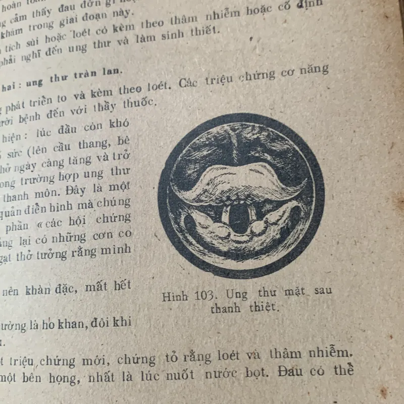 Tai mũi họng thực hành, hình vẽ minh hoạ, Võ Tấn 608499