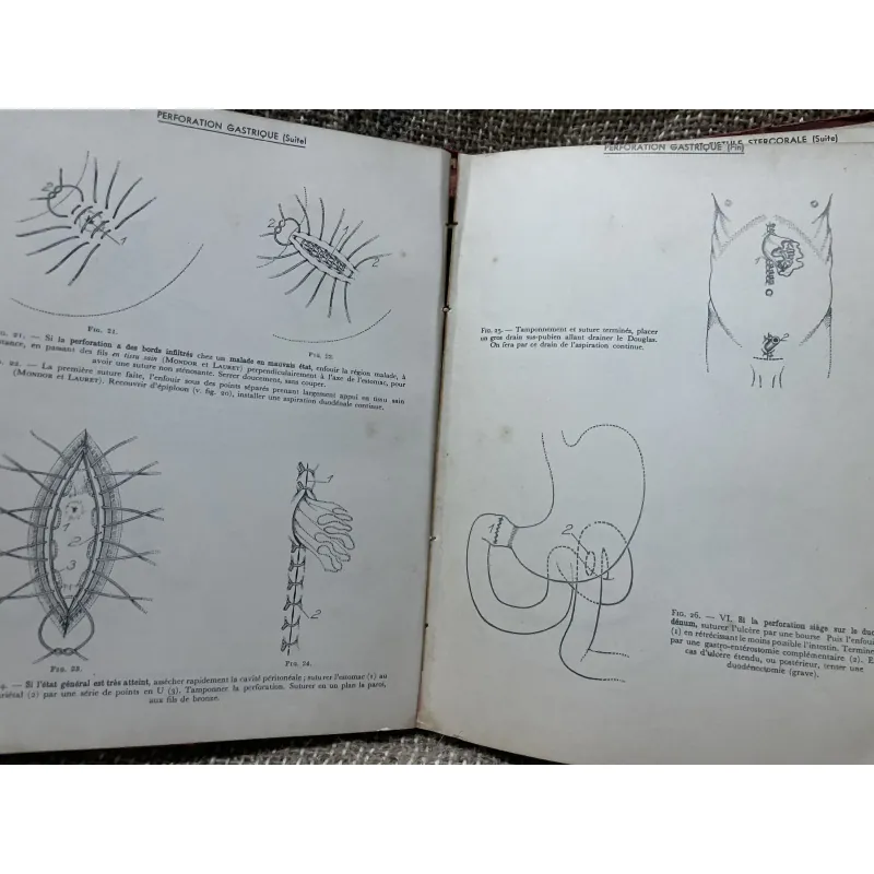 Kthuật phẫu thuật bằng hình ảnh -TECHNIQUE CHIRURGIEALE EN FIGURES G.JEANNENEY& J.MAGENDIE 1006345