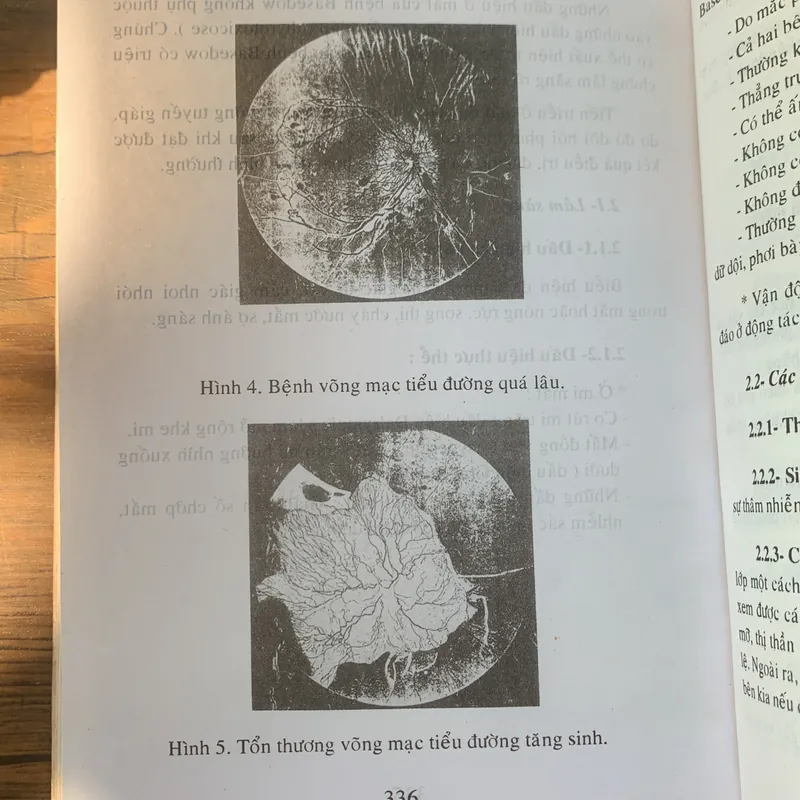 Giáo trình nhãn khoa, Nguyễn Xuân Trường 713182