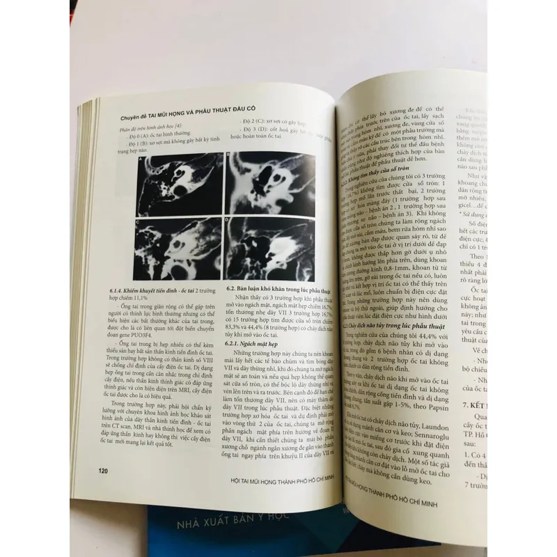 📚 2 TẬP CHUYÊN ĐỀ TAI - MŨI - HỌNG VÀ PHẪU THUẬT ĐẦU CỔ 601905