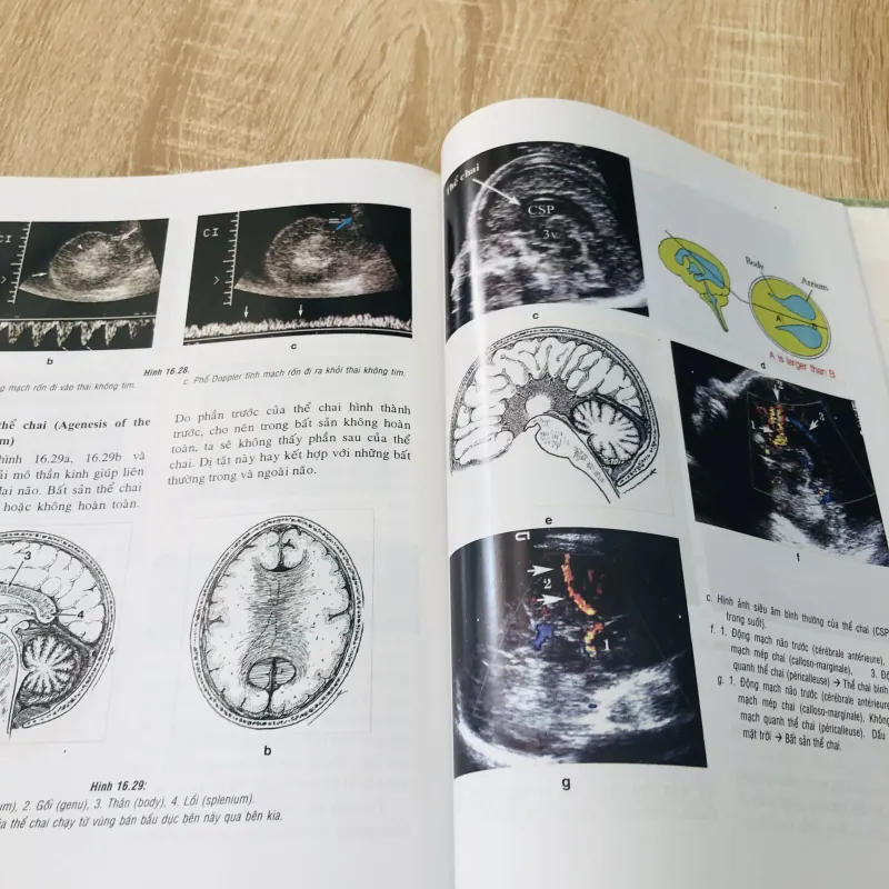 SIÊU ÂM SẢN KHOA THỰC HÀNH  974768