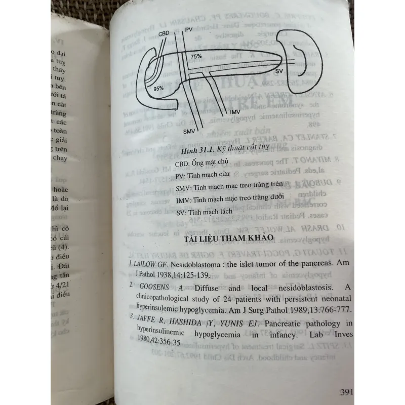 Phẫu thuật tiêu hóa trẻ em - Ts Lê Thanh Liêm ; gần 400 trang  1025098