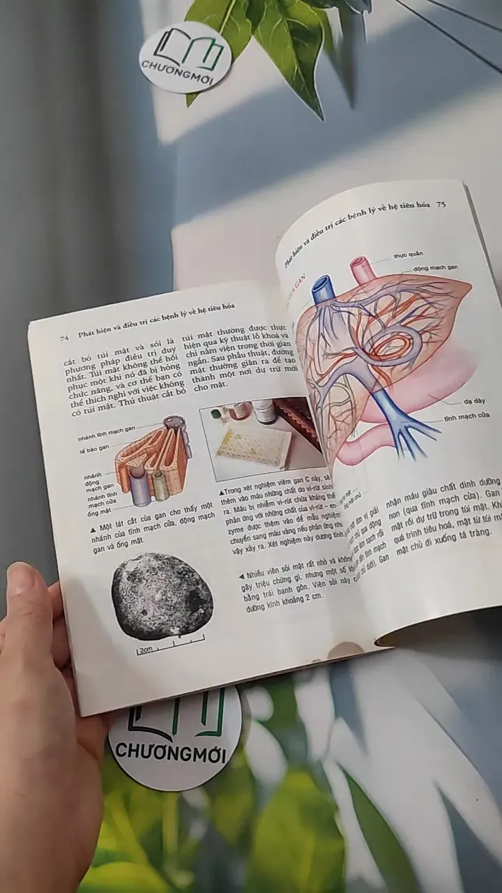 Phát Hiện Và Điều Trị Các Bệnh Lý Về Tim Và Hệ Tuần Hoàn - Hệ Tiêu Hóa 780800